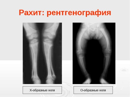 А икорки с утра пораньше в понедельник не желаете?