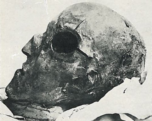 Тайна гибели короля Карла XII. Мумии и скелеты. 6