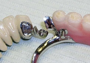 беззубый страдалец или стоматологические сопли