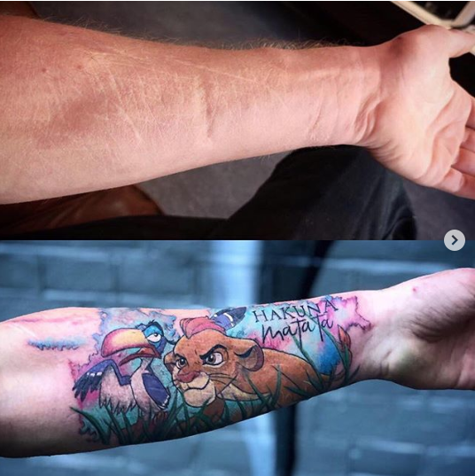 17 невероятных татуировок, которые превращают недостатки в достоинства