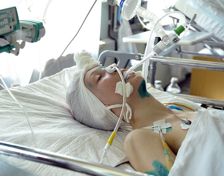 Women oxygen medical bondage