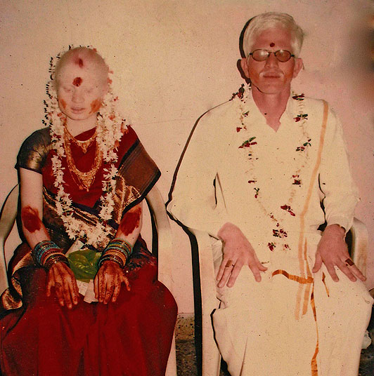 Индийская семья альбиносов
