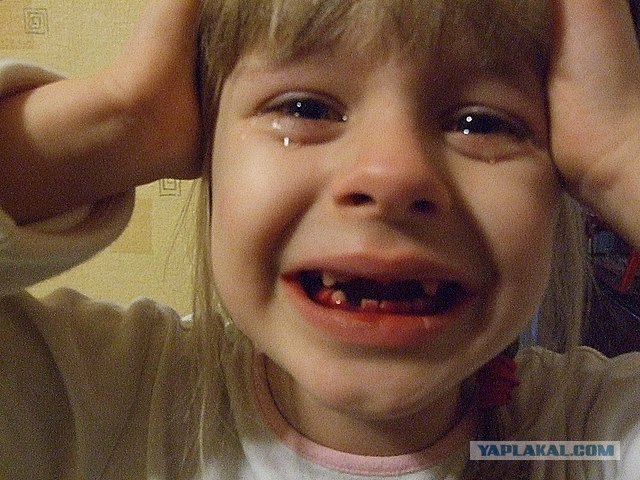 Правильный способ вырвать себе зуб - ЯПлакалъ