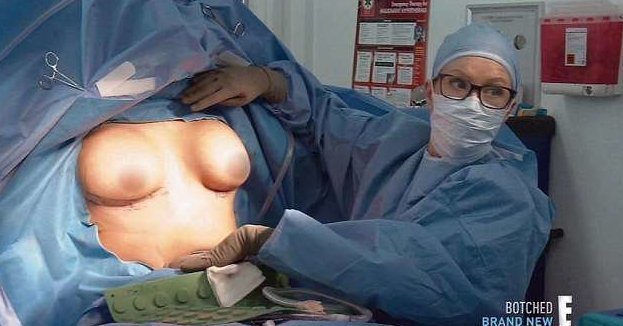 В результате неудачной пластической операции у девушки раздвоилась грудь