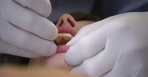 40 удивительных случаев, когда стоматологи творили чудеса
