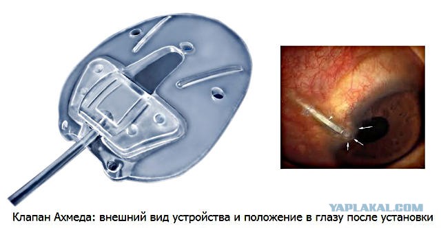 Началось все просто и банально...