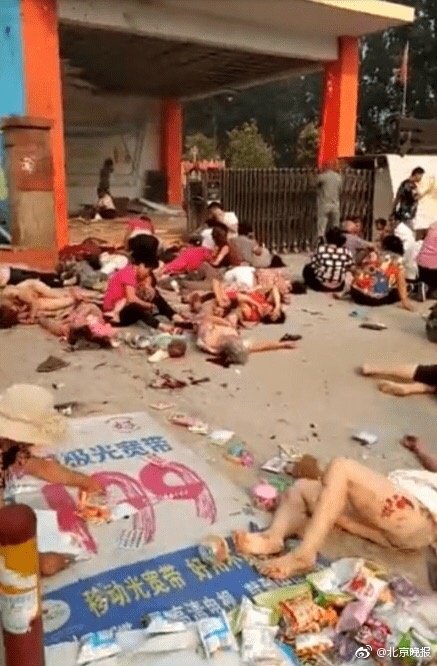 Вибратор Взорвался В Вагине Фулл