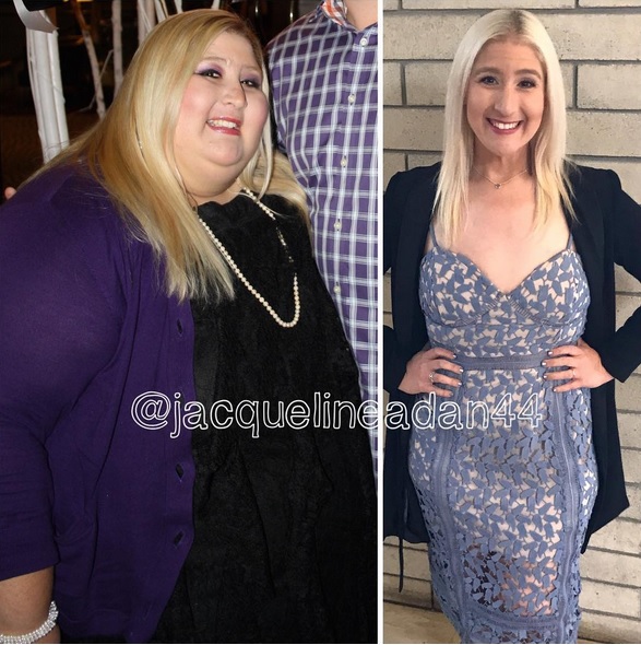Женщина похудела на 160 килограммов,но теперь стала причиной насмешек