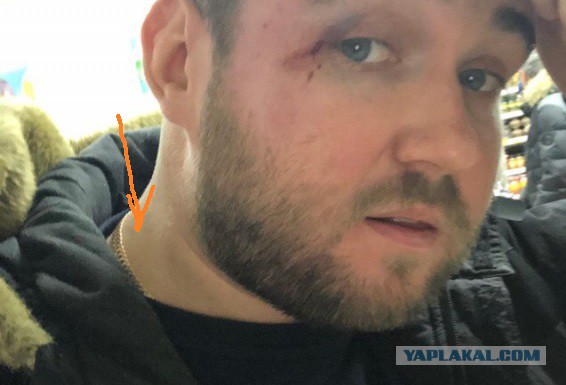 «Я не националист, но меня избили лица кавказской национальности»: В Москве продавец избил покупателя