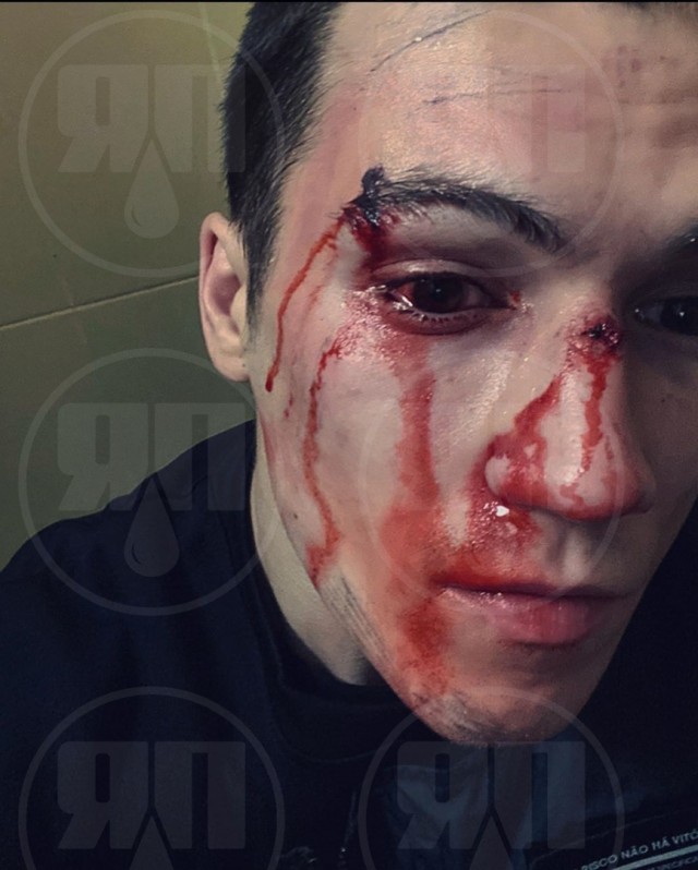 Хулиганы толпой избили бойца ММА в Москве