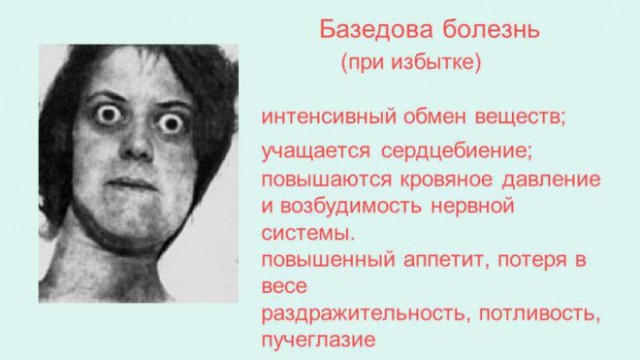 Китаянка изменила разрез глаз, потратив $35 тыс., чтобы выглядеть "по-европейски"