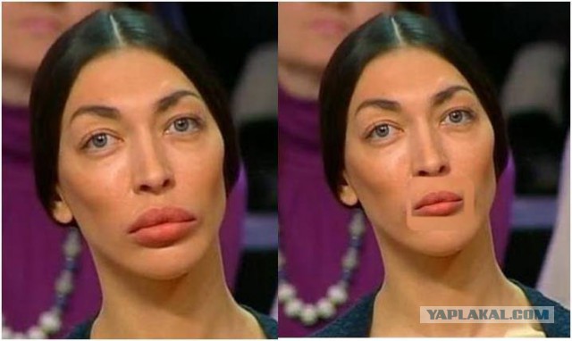 Как выглядит женщина, потратившая 10 миллионов рублей на «переделку» внешности