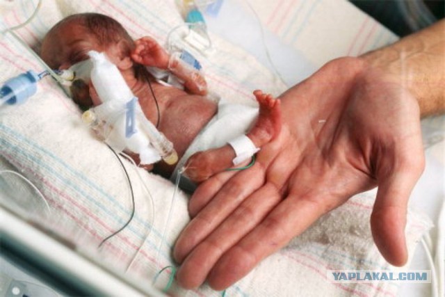 Рождение ребенка как подвиг и как чудо: самые необычные мамы в мире