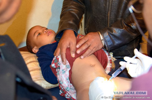 В Новой Москве двухлетний мальчик впал в кому после обрезания на дому.