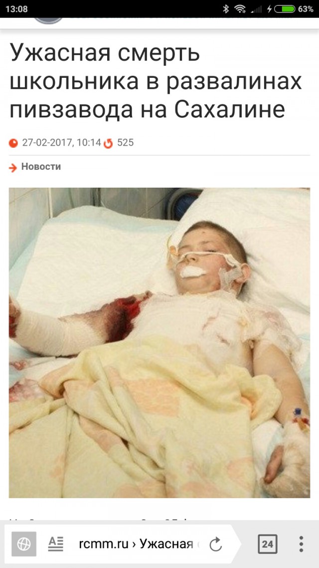 Житель Омска сломал мальчику позвоночник и избил за кражу часов