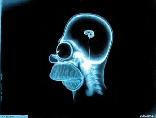 Путин указал на ошибку ИИ в исследовании МРТ головного мозга пациента