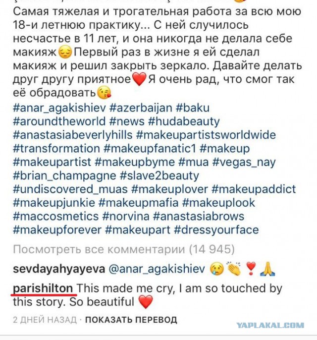 Реакция азербайджанки с обезображенным лицом на первый макияж растрогала пользователей соцсетей