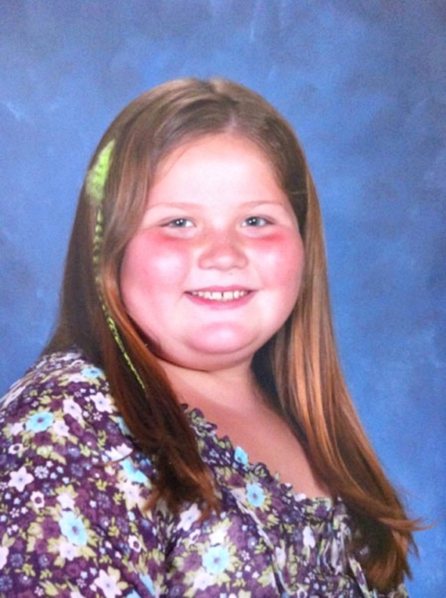 Все дети в классе травили эту 9-летнюю девочку из-за её огромного веса