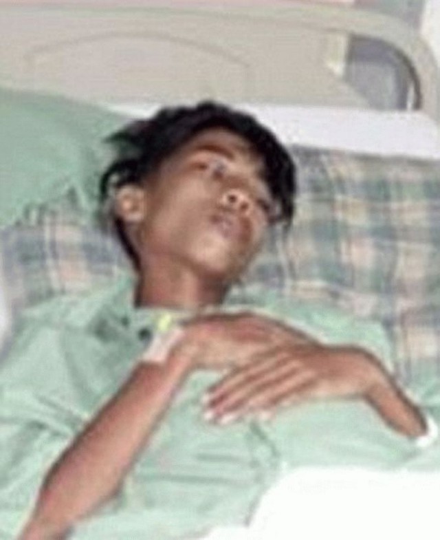 15-летний парень стал жаловаться на боль в животе