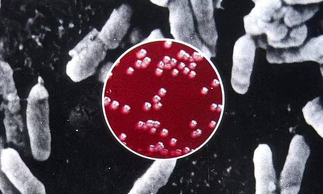 Мужчина в Нью-Мексико умер от бубонной чумы в результате первого смертельного случая в США за последние годы