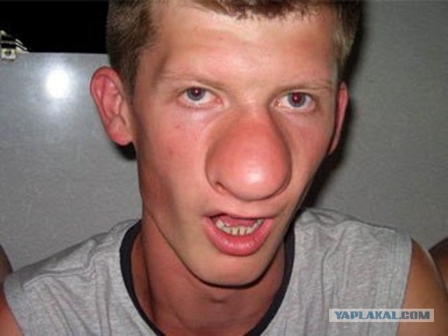 Самый прыщавый человек