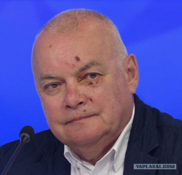 Телеведущий Дмитрий Киселев объяснил разбитое в Крыму лицо сменой имиджа, которая «отражает его позицию
