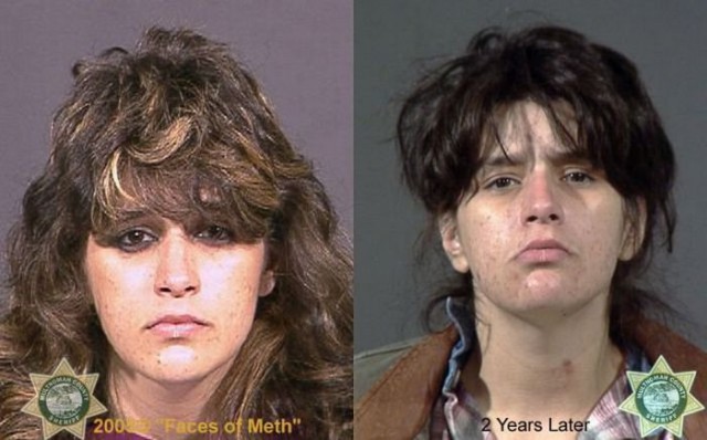 Наркоманы до и после