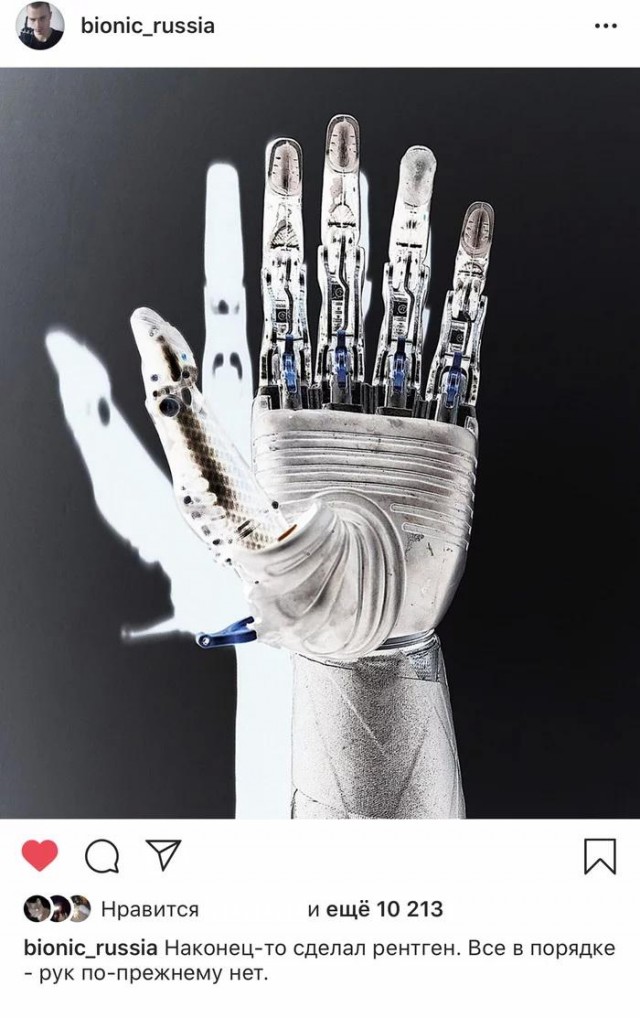 Ответы на вопросы: Бионические руки