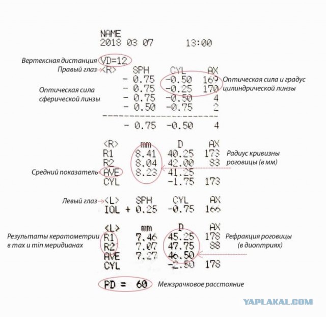 Что ищут офтальмологи у пациентов с астигматизмом?