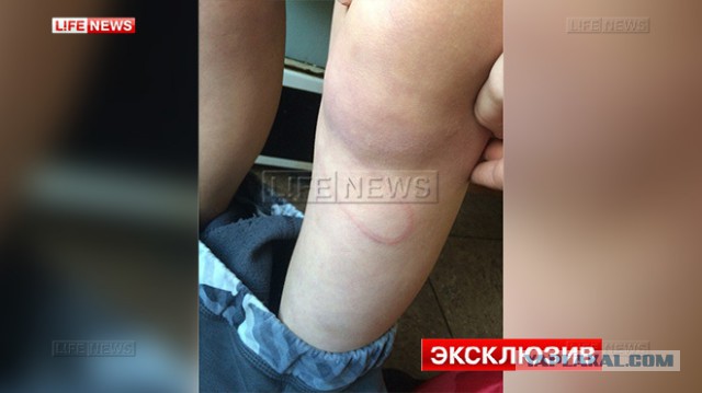 В Омске учитель физкультуры скакалкой избила мальчика