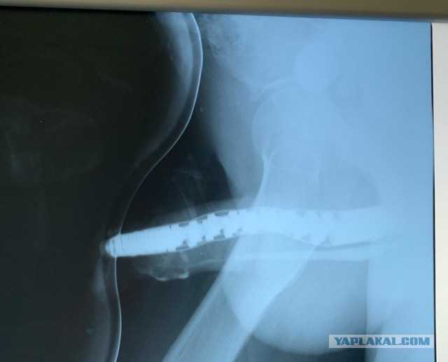 Фаллоимитатор Застрял