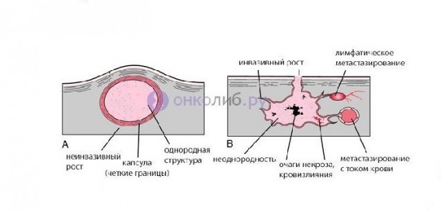 Медицинского ЯПросвещения пост. Опухоли