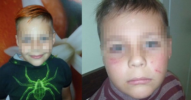 В Новосибирске хулиганы избили третьеклассника, назвав его «русской свиньёй»