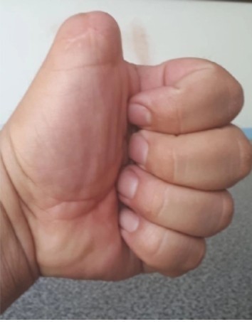 Деградация с баяном