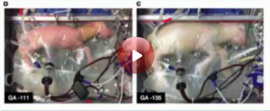 Ученые успешно вырастили эмбрион ягненка в искусственной утробе