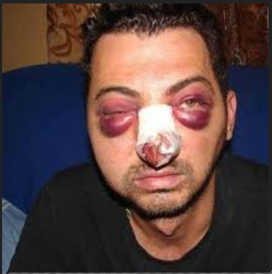 Субарист влетает в пробку