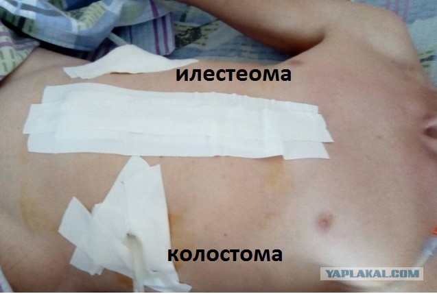 Жителю Ханты-Мансийска порвали кишки в полиции
