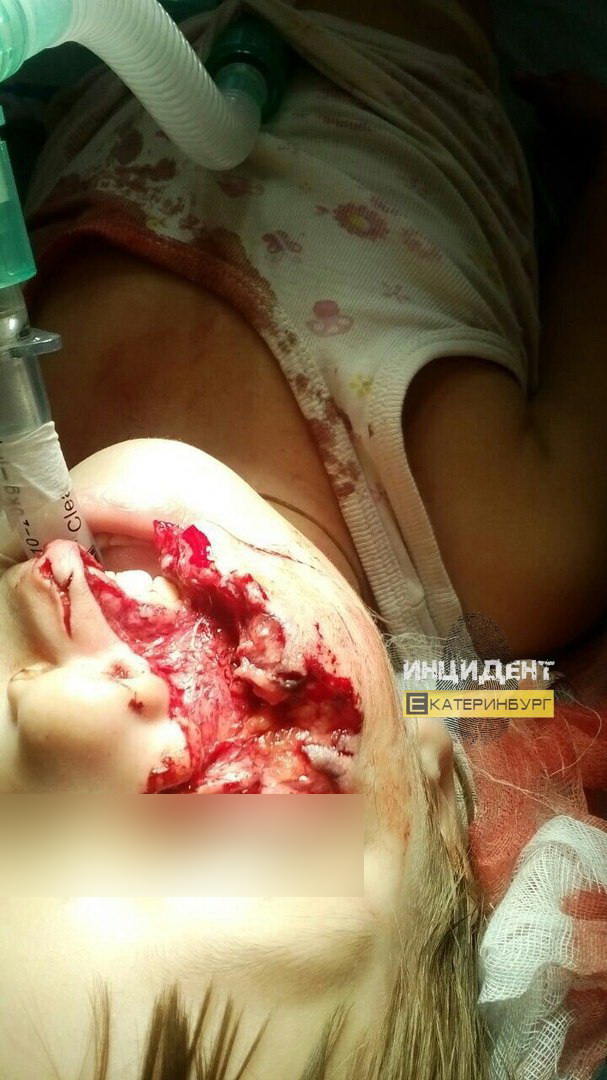 В Самаре стая бродячих собак напала на девушку, это увидели парни на машине и решили не проезжать мимо