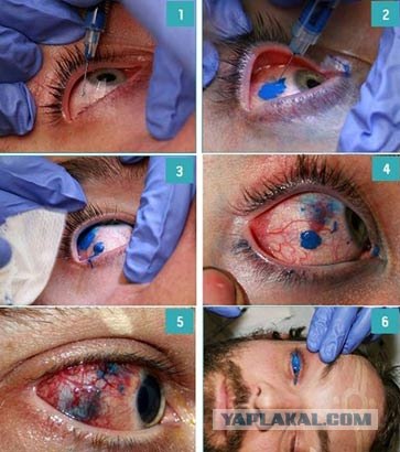 Девушка сделала тату имени парня на лице