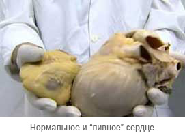 Про пиво