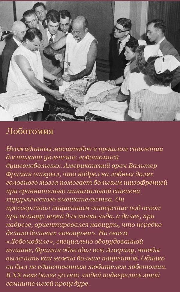 Лоботомия это для чего. Лоботомия презентация. Транс орбитальная лоботомия. Лоботомия уолтер. Лоботомия это для чего.