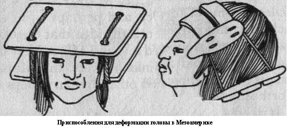 Деформация головы