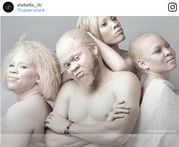 Фотографии, доказывающие, что генетика — штука непредсказуемая