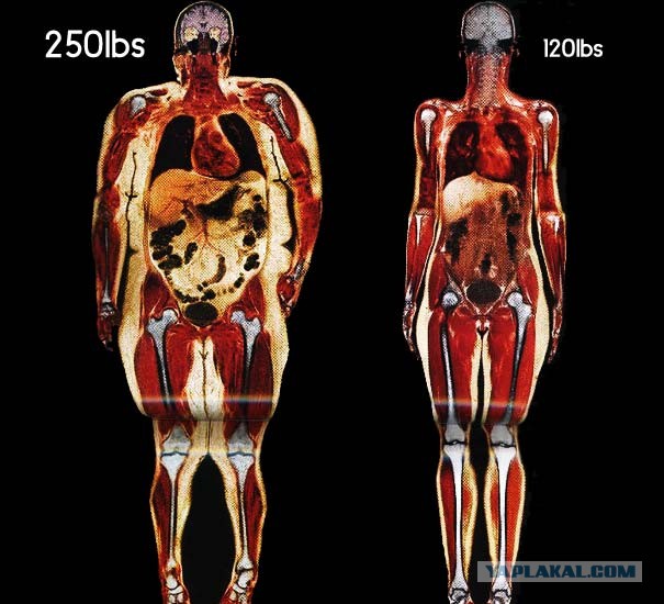 Комплекс неполноценности? Не-а, не слышала!