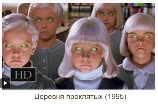 В Нижнем Тагиле родился ребёнок-альбинос
