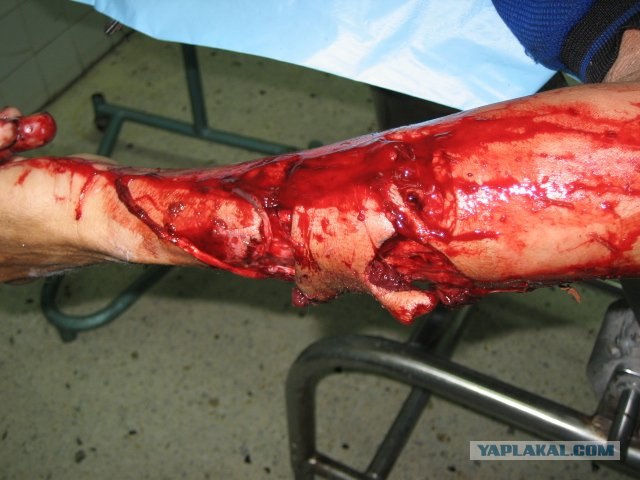 Догхантеры травят собак порошком в парках