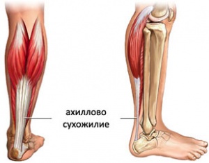 Т-толерантность