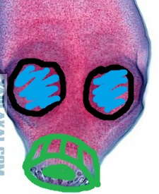 Красноярские хирурги достали из печени мужчины огромного червя