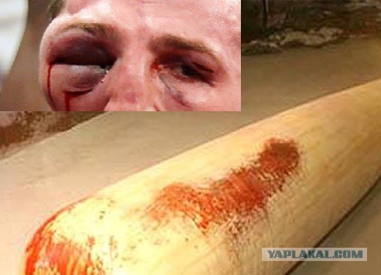 НАРКО-СТОП. Новый выпуск.