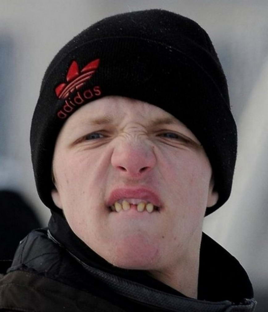 Признаки Чмошника